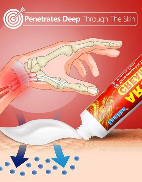 Load image into Gallery viewer, 10G/20G Tendon Sheath Ointment Hand Joints Wrist Finger Arthritis Pain Relief Therapy Tenosynovitis Pain Cream Oil
